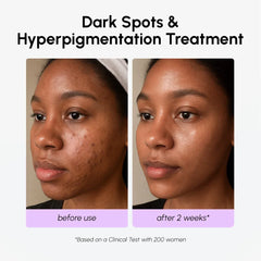 Dark Spot Corrector
