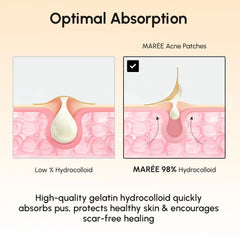 Gold Star Pimple & Acne Patches